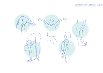 Jak rozpoznać hipermobilność? Skale diagnostyczne